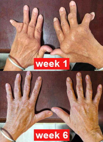 Fivfivgo™ Bee Venom Advanced Joint and Bone Therapy Cream 14 Fivfivgo™ Bee Venom Advanced Joint and Bone Therapy Cream