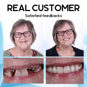 Bearnica ™ Silicone Reline Denture Set