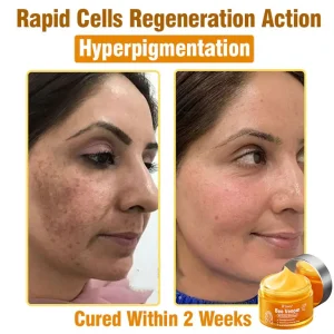 Daasry® Bee Venom Skin Treatment Serum Cream