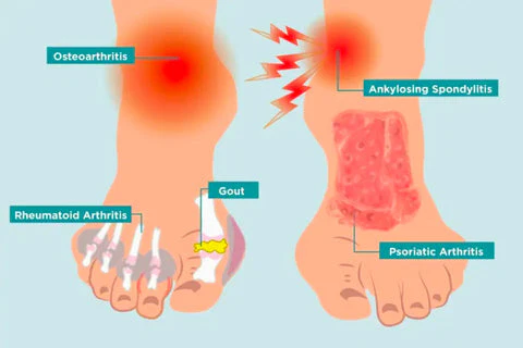 Fivfivgo™ Bee Venom Advanced Joint and Bone Therapy Cream 11 Fivfivgo™ Bee Venom Advanced Joint and Bone Therapy Cream