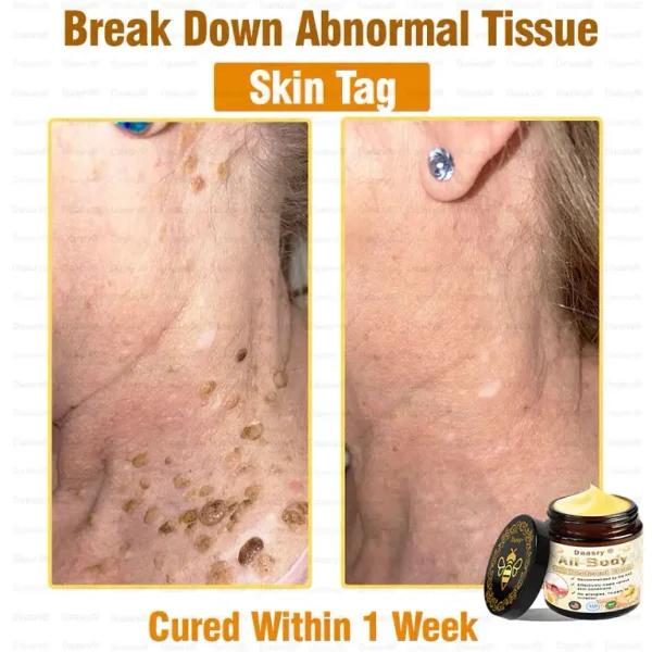 Daasry® All-Body Skin Treatment Cream