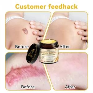 HZA™ Bee Poison Skin Treatment Cream