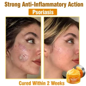 Daasry® Bee Venom Skin Treatment Serum Cream