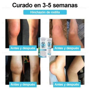 Aeehfeng™ Creman Reparadora Articulacions congs Hialurnico … dolores musculare