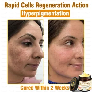 Daasry® All-Body Skin Treatment Cream