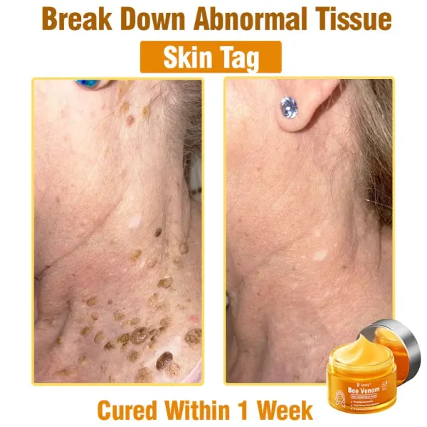 Daasry® Bee Venom Skin Treatment Serum Cream