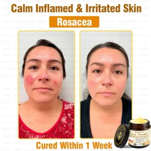 Daasry® All-Body Skin Treatment Cream