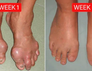 Fivfivgo™ Bee Venom Advanced Joint and Bone Therapy Cream 37 Fivfivgo™ Bee Venom Advanced Joint and Bone Therapy Cream