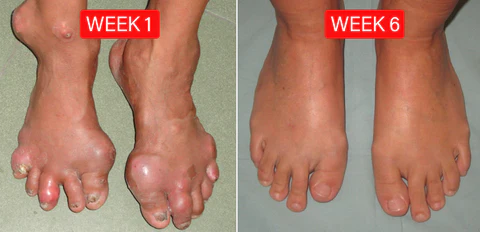 Fivfivgo™ Bee Venom Advanced Joint and Bone Therapy Cream 15 Fivfivgo™ Bee Venom Advanced Joint and Bone Therapy Cream