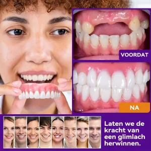 Bikenda ™ Silicone Herstel Denturset
