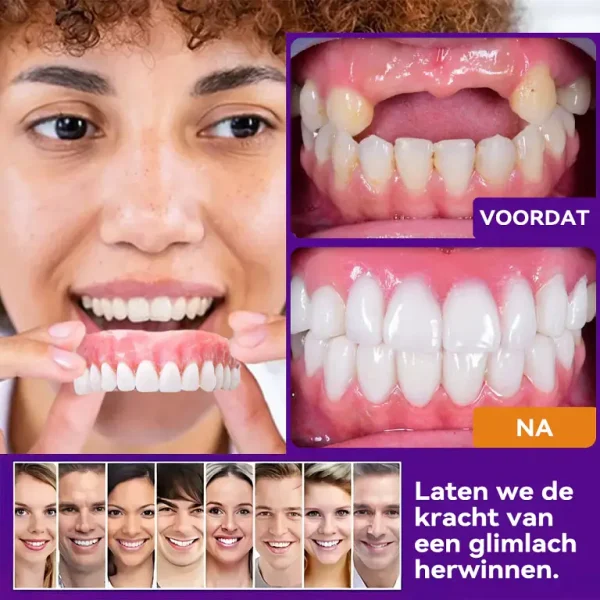 Bikenda ™ Silicone Herstel Denturset