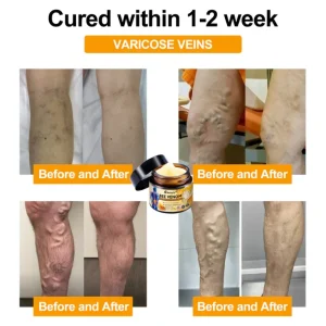 Aetheris™ Bee-Venom Pain- Relief Bone Healing Cream
