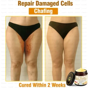 Daasry® All-Body Skin Treatment Cream