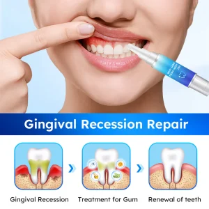 LOVILDS™ Oral Gum Treatment Gel 16 LOVILDS™ Oral Gum Treatment Gel