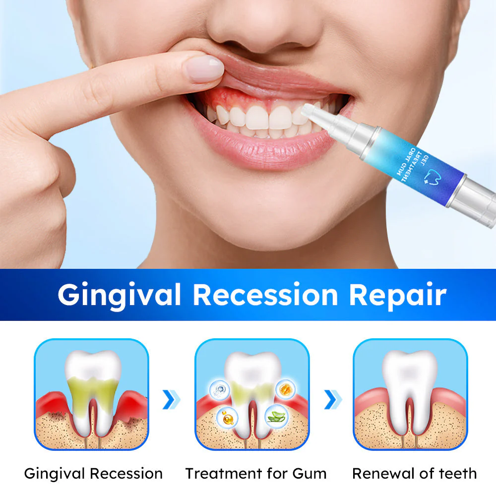 LOVILDS™ Oral Gum Treatment Gel 5 LOVILDS™ Oral Gum Treatment Gel