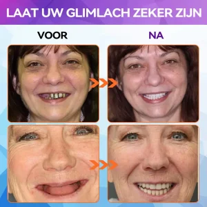 Bikenda ™ Silicone Herstel Denturset