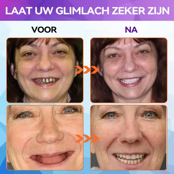 Bikenda ™ Silicone Herstel Denturset
