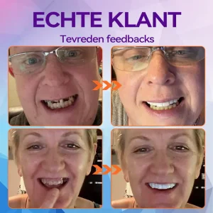 Bikenda ™ Silicone Herstel Denturset