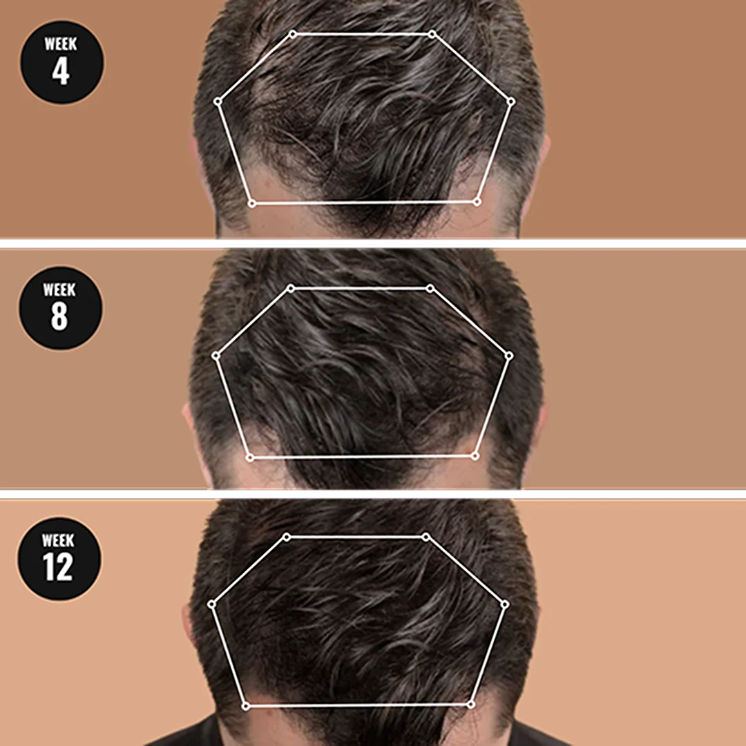 Root Activator Shampoo™ - Sale 6 Root Activator Shampoo™ - Sale