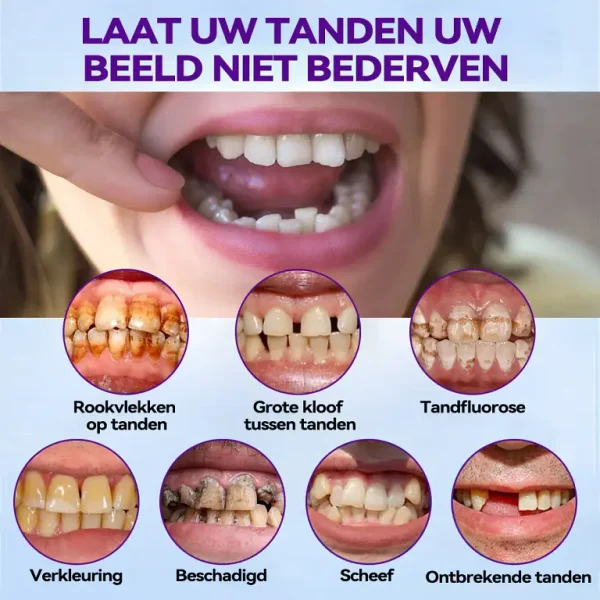 Bikenda ™ Silicone Herstel Denturset