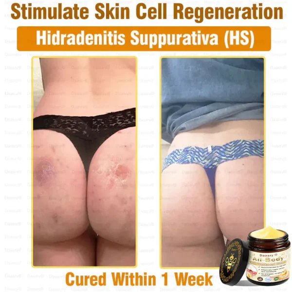 Daasry® All-Body Skin Treatment Cream
