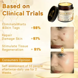 HZA™ Bee Poison Skin Treatment Cream