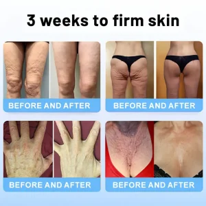 Flysmus™ Collagen Peptides FIRMING SERUM STICK 10 Flysmus™ Collagen Peptides FIRMING SERUM STICK