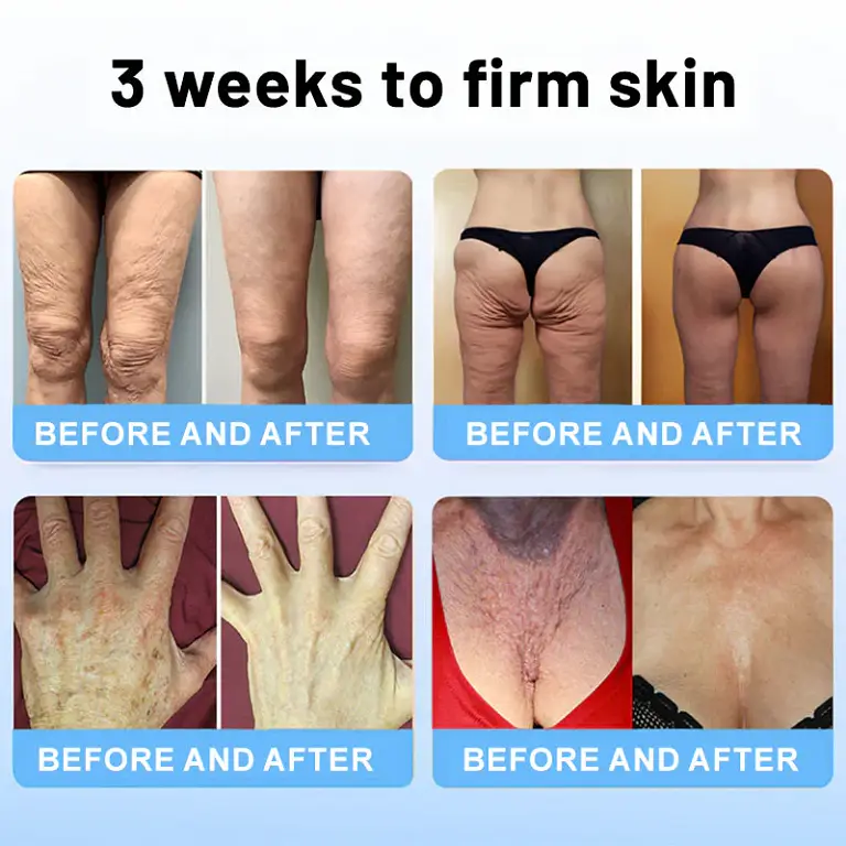 Flysmus™ Collagen Peptides FIRMING SERUM STICK 5 Flysmus™ Collagen Peptides FIRMING SERUM STICK