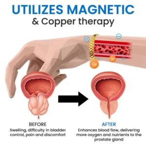DISYAN™ Prostate Magnetic Therapy Bracelet