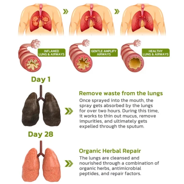 Ourlyard™ FreeLunga Herbal Lung Cleanser Spray