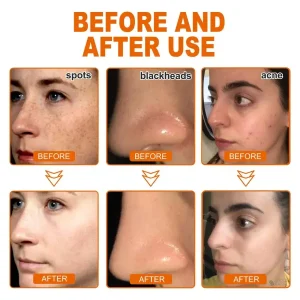 BBOJI™ Whiten and Lighten Spots Mask 9 BBOJI™ Whiten and Lighten Spots Mask