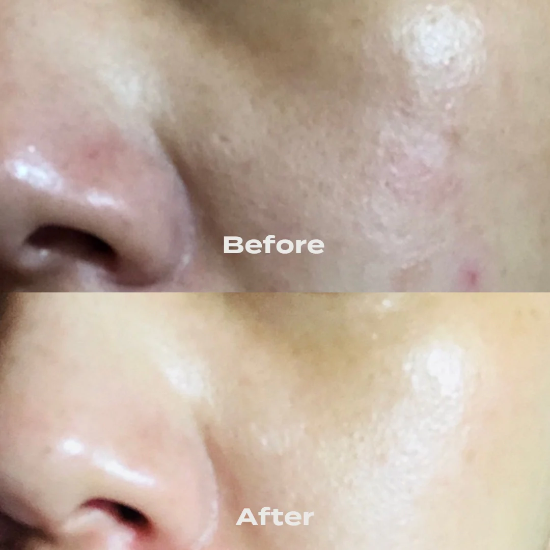 B-Restore™ Barrier Cream + Free 20g Travel Size 2 B-Restore™ Barrier Cream + Free 20g Travel Size