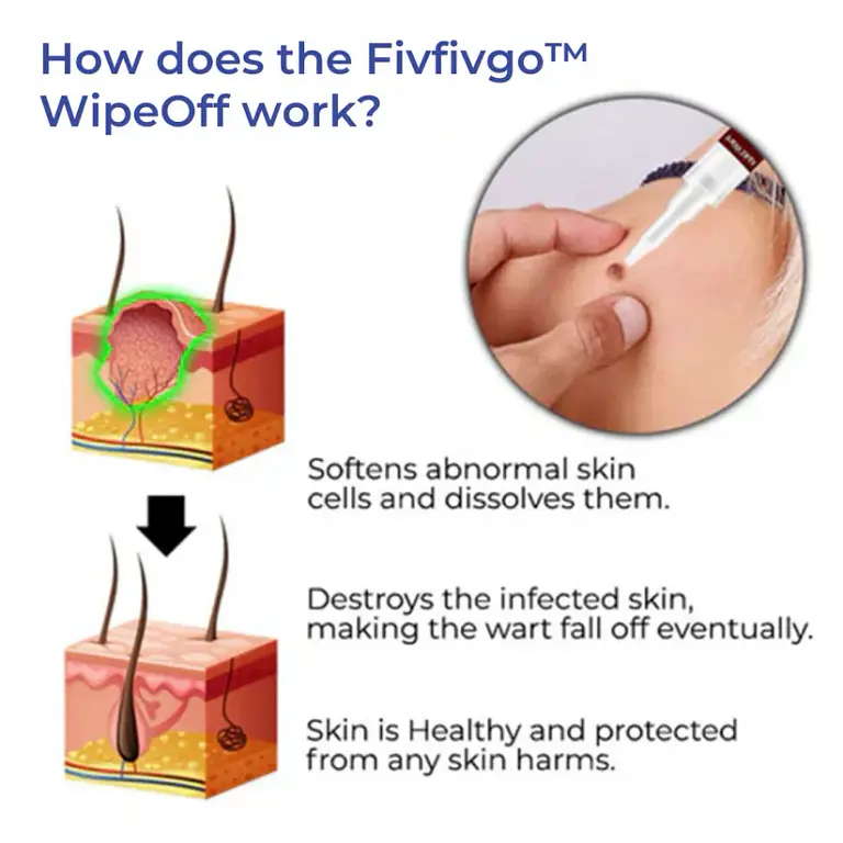 Winter Sale Fivfivgo™ WipeOff Tags & Maulwurfsentferner 7 Fivfivgo™ WipeOff Tags & Maulwurfsentferner