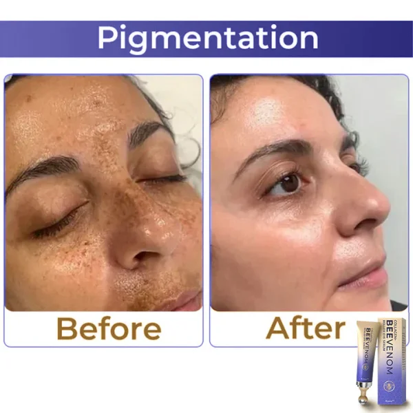flysmus™ Collagen+ Bee Venom Roller Eye Cream 🇦🇺 Dermatologist Approved