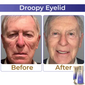 flysmus™ Collagen+ Bee Venom Roller Eye Cream 🇦🇺 Dermatologist Approved