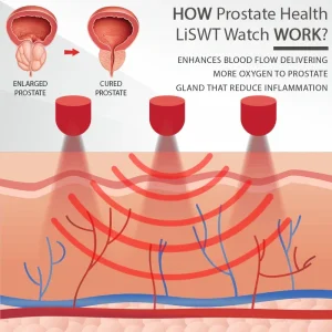 RICPIND™ ProstateMale Health LiSWT Watch