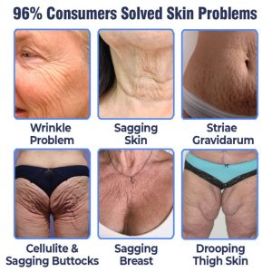 flysmus™ Advanced Firming & Wrinkle Reducing Lotion