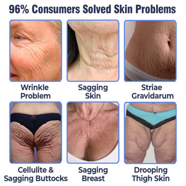 flysmus™ Advanced Firming & Wrinkle Reducing Lotion