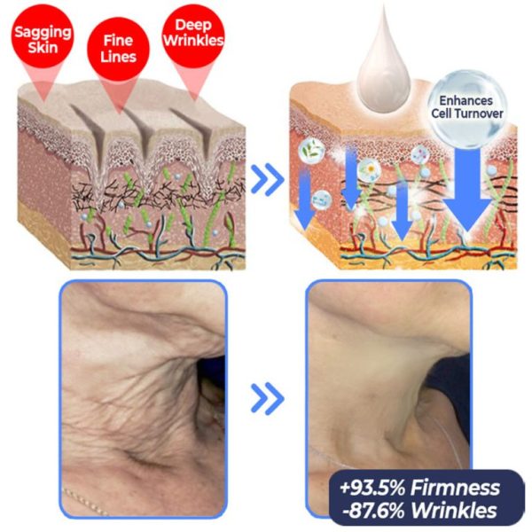 flysmus™ Advanced Firming & Wrinkle Reducing Lotion