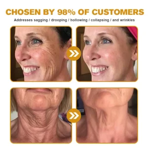 Furzero™ Botox Bee Venom Wrinkle Remover Cream