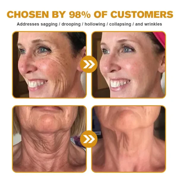 Furzero™ Botox Bee Venom Wrinkle Remover Cream