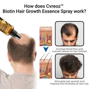 Cvreoz™ Biotin Hair Growth Essence Spray