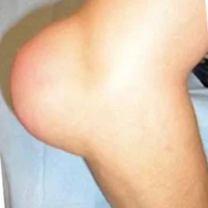 Fivfivgo™ Bee Venom Advanced Joint and Bone Therapy Cream 35 Fivfivgo™ Bee Venom Advanced Joint and Bone Therapy Cream