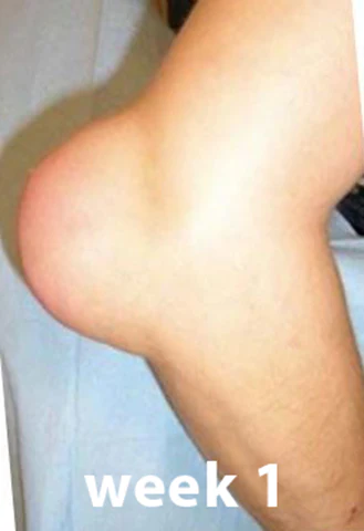 Fivfivgo™ Bee Venom Advanced Joint and Bone Therapy Cream 13 Fivfivgo™ Bee Venom Advanced Joint and Bone Therapy Cream