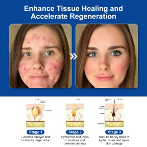 LOVILDS™ Bee Venom Skin Treatment Cream (AAD Recommended👨‍⚕️)