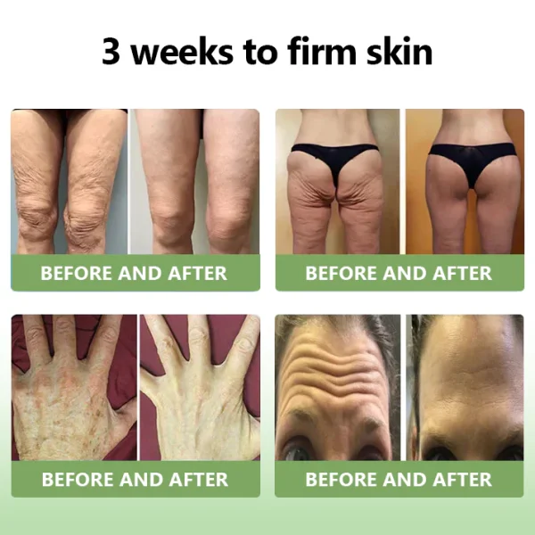 LOVILDS™ Luxurious Collagen Firming Cream
