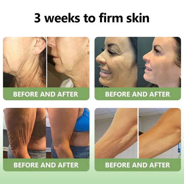 LOVILDS™ Luxurious Collagen Firming Cream - Image 8