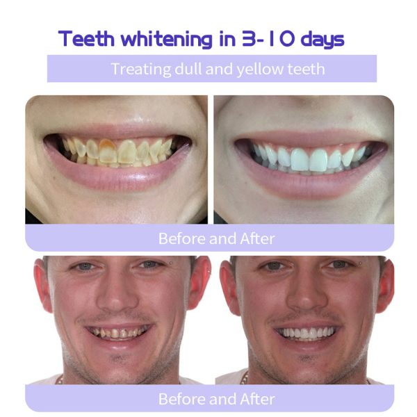 Exclusive Deal Oyikey™Tooth Repair Mineral Powder - Image 13