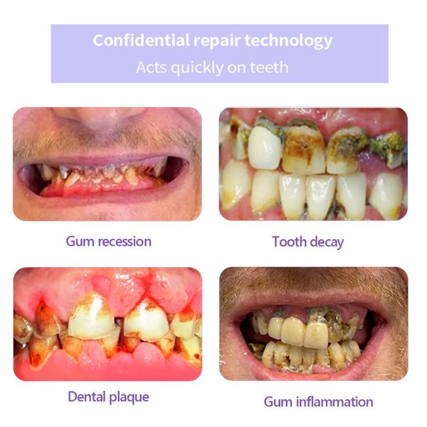 Exclusive Deal Oyikey™Tooth Repair Mineral Powder - Image 14