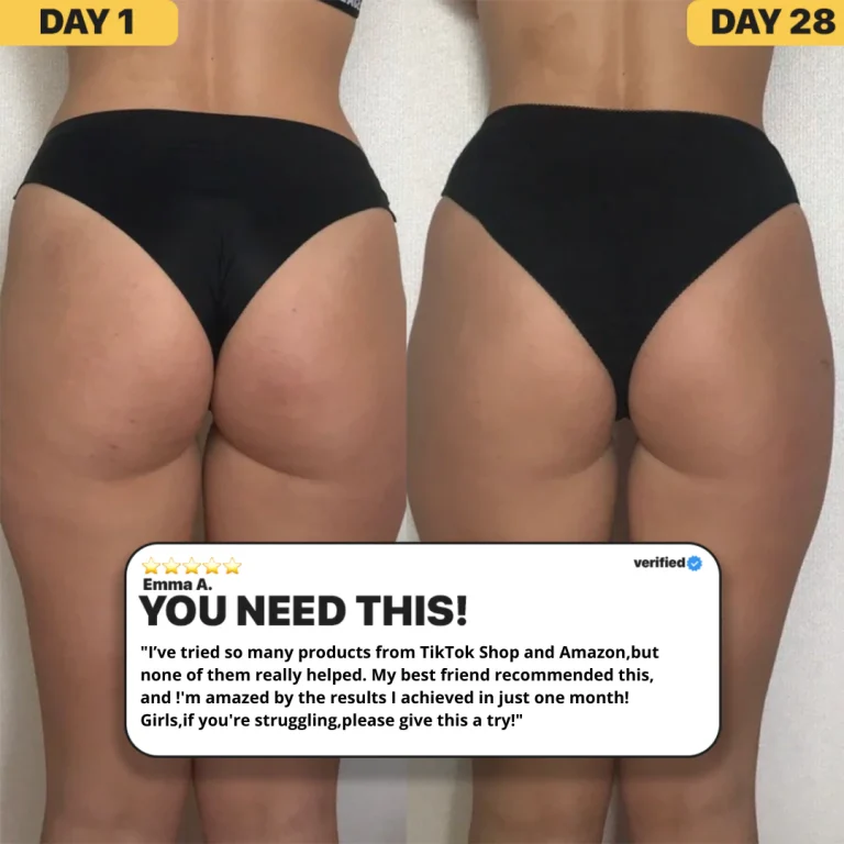 Mega Sale SheVitality™ Cellulite Relief In 30 Days 12 SheVitality™ Cellulite Relief In 30 Days